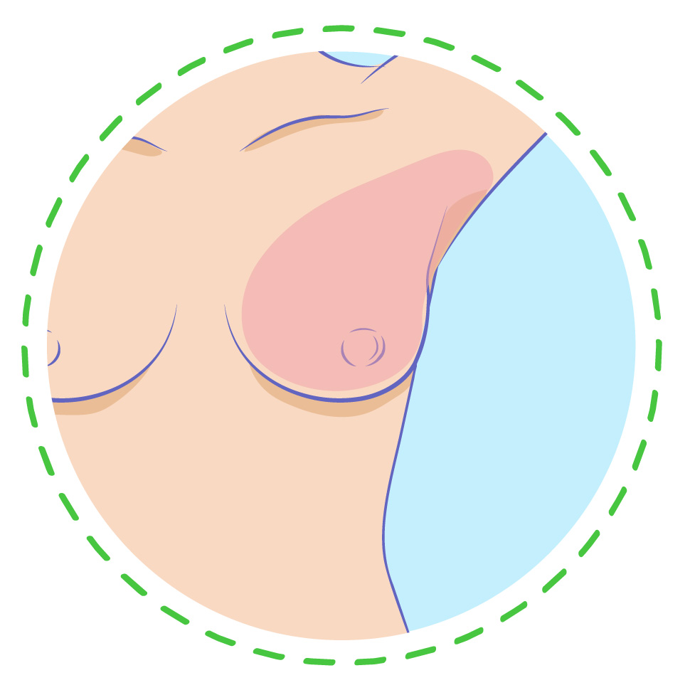 An illustrated diagram highlighted in a circle showing the boundary area of a breast self-exam, including the breast tissue extending up toward the underarm.