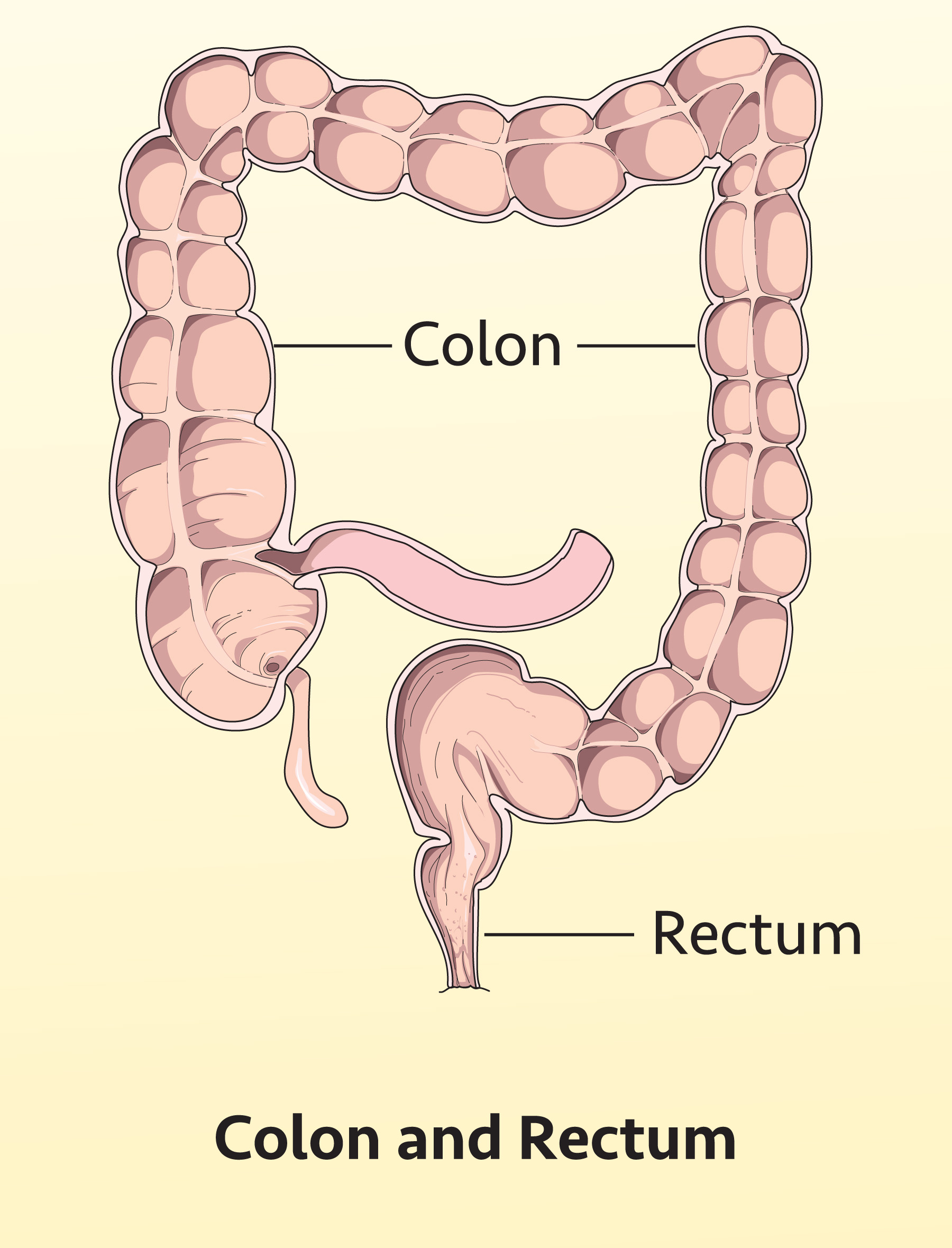 Colon_Ill-1