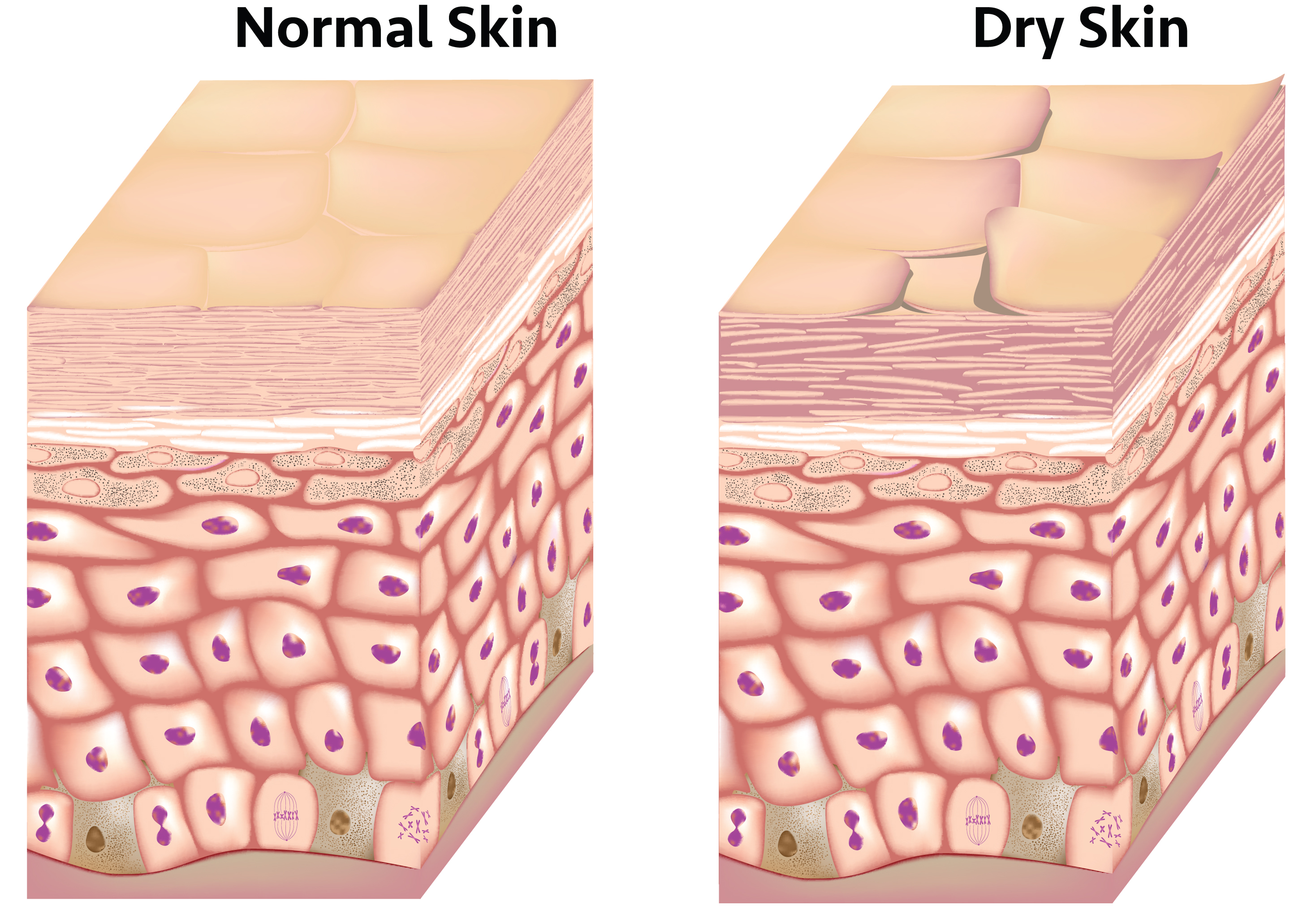 Dry-Skin-17920240_Ill-1