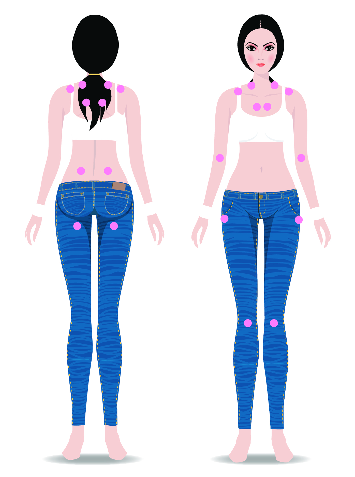 Illustration designating "tender" points of fibromyalgia on the front and back of a human figure. 