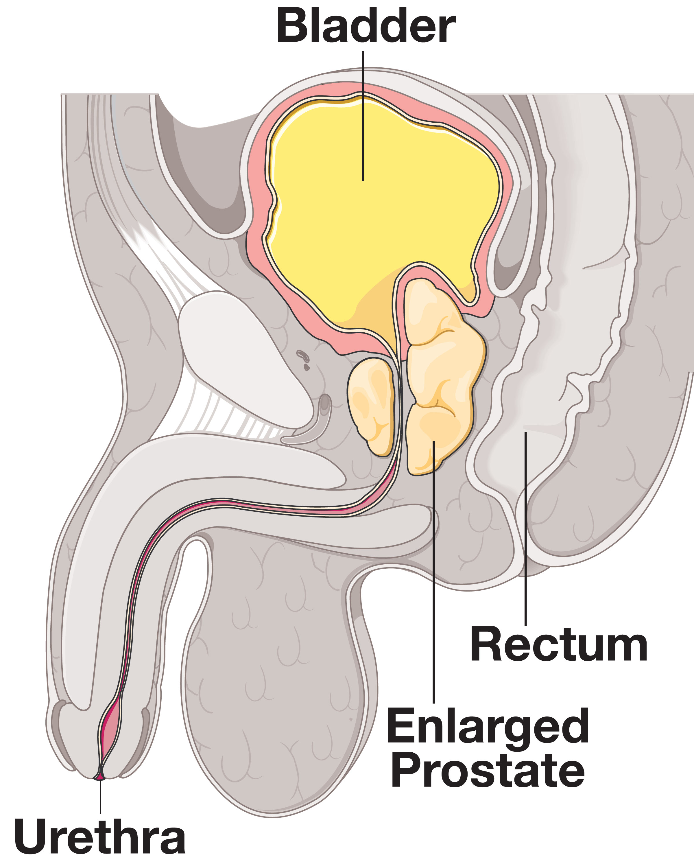 Prostate_ill_web