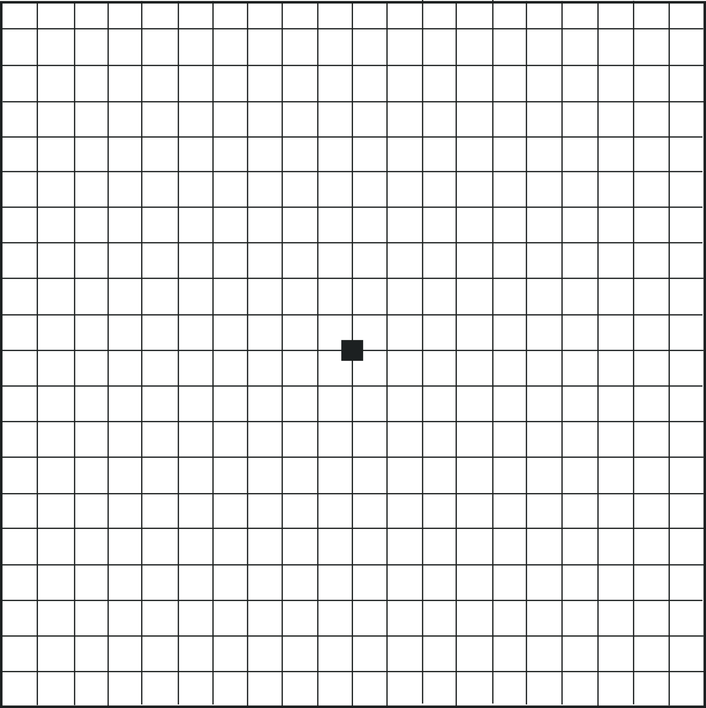 macular-degeneration-Ill-2